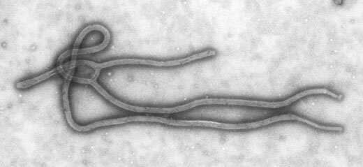 Ebola hemorrhagic fever (EHF)