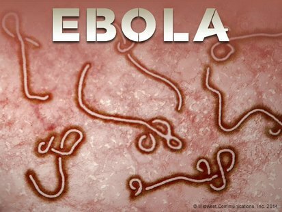 Ebola Virus Disease